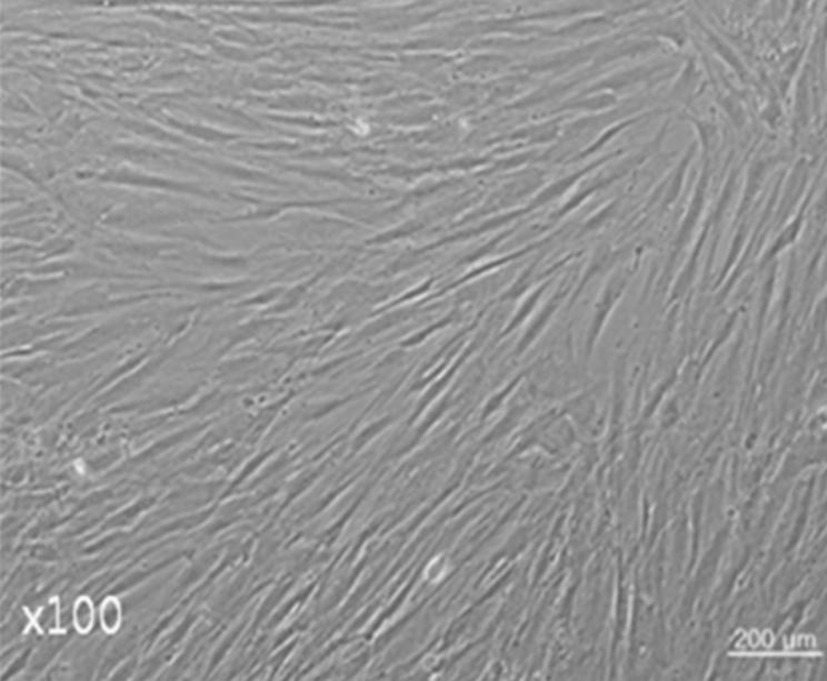 Isolation of MSCs in the Bone Marrow Processing Kit β3 (10 ng/ml) 를첨가하였다. 연골세포로의분화유도 2주후에 Safranin-O staining을통해서연골세포분화여부를확인하였다. 결과 1. 부착성세포의분리및배양골수처리키트내에남아있는골수로부터회수한단핵세포는평균 1 10 8 개이었다 (n=4).