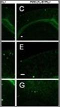 중간엽줄기세포의아밀로이드베타축적감소효과 도표 17.