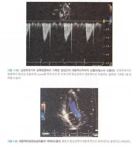 (2) 대동맥시작부의도플러 - 심장꼭대기 ( 심첨부 ) 5강위치에서대동맥판막바로위에서기록 -