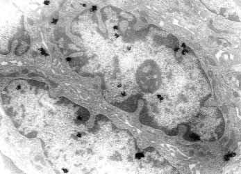 염색질경계면에서의 mrna 합성 95 Fig. 3. High power view of carcinomatous squamous cells. Silver grains are not noted in the nucleoli ( 17,400). Fig. 5.