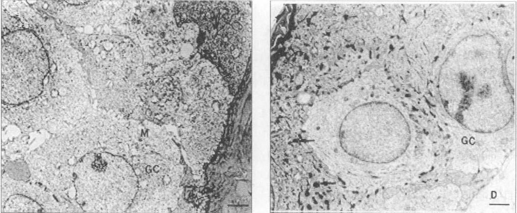 하게되어막의유동성이떨어지게되는데이는 세포막기능의감소와직 간집적으로관련되어 있다 피부에존자 } 하는세포외기질불칠의변화도 Fig. 3. An electron micrography of the skin of aged mouse.