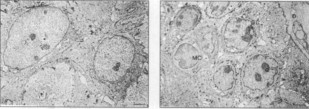An electron micrography of the skin treated with squalene at 3 days. A few of germative cells(gs) are differentiated. mitochondria(m).