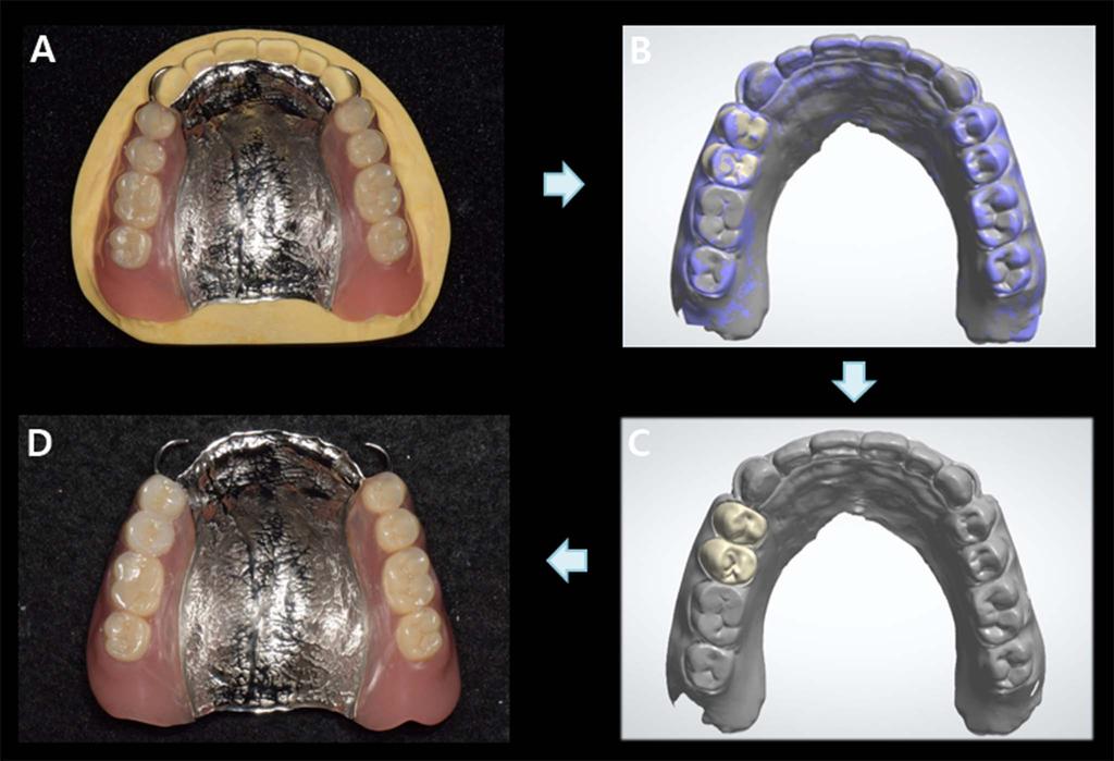 position, (F) left lateral view, (G) working side during right lateral excursion, (H) mandibular occlusal view, and (I) balancing side during right lateral excursion. Fig. 9.