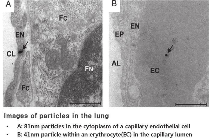 Fig. 1. Images of paticles(arrows) in the lung parenchyma(hei, 2013) 해서혈액을통해전신순환을할수있기때문에심혈관계질환의발생과직접적인관련이있다 ( 신동천, 2007).
