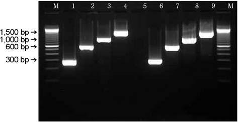 88 MJ Kim, et al. Figure 5. PCR result for the detection of espa (299 bp), espb (633 bp), espd (939 bp) and tir (1,550 bp) genes.