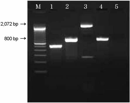 Multiplex PCR analysis of the saa (119 bp), eae (384 bp), the ehxa (534 bp) genes.