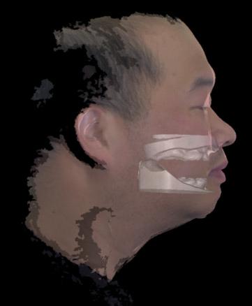 view. Fig. 8. Virtual evaluation using 3D face scan.