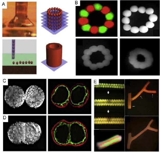 3-dimensional (3D) Bioprinting of scaffold-free tissue engineered constructs (A) Extrusion printing of cell aggregates and schematic depiction of cell printing, 3D positioning of overlaid spheroids,