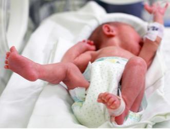 1-b. 뉴모스템 PNEUMOSTEM ( 미숙아란? 재태기간이 37 주미만에태어난아기혹은 2.
