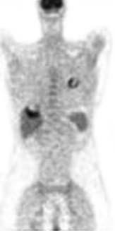 의료기기품목시장리포트 < 표 5> CT, PET 및 PET/CT 비교 CT PET/CT 원리 : 빛에너지인 X 선을 360 도각도에서촬영해영상화. 특징 : 조직의밀도차이를구별하며특히움직이는장기 ( 심장, 폐, 내장 ) 촬영에적합함.