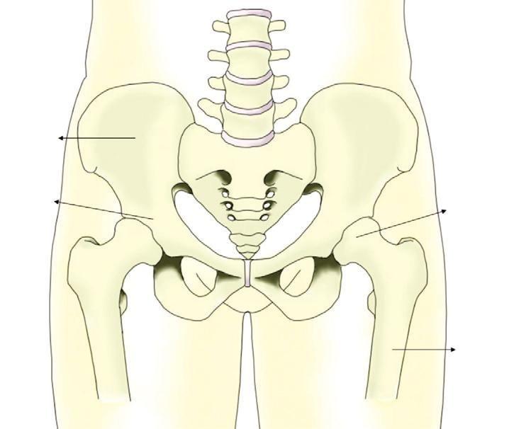 종합병원서울성심병원 본자료는대한정형외과학회학회지에기재된자료를환자분들이편하게이용하실 수있도록재구성한것입니다. 대퇴골두무혈성괴사 1. 개요 골반골 비구 대퇴골두 대퇴골두( 머리) 는허벅지뼈 ( 대퇴골) 의골반쪽끝부분으로 공모양( 구형) 을하고있으며 골반골의비구와맞물려고관 절( 엉덩이관절) 을이루고있 습니다.