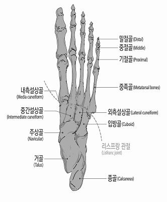 말하며, 뼈단면이불규칙해진상태나발가락길이의단축없이골편만떨어진상태는해당하지않는다.