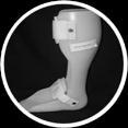 30 사람의다리, 발목과발의손상된기능이나형태를치료또는보완화기위한신발 보조기 17 족외전 / 만곡족교정기만곡족치료에사용되는기구 18 발목 - 발보조기 (AFO) 06.12.