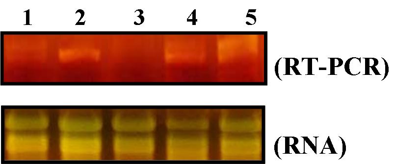 Fig. 14. Expression analysis of N1 chitinase by RT-PCR in Bacillus subtilis 168/pBex WH 1-4, B. subtilis 168, B. amyloliquefaciens A-2, B. amyloliquefaciens A-2/pBex WH 1-4 1, B. subtilis 168; 2, B.