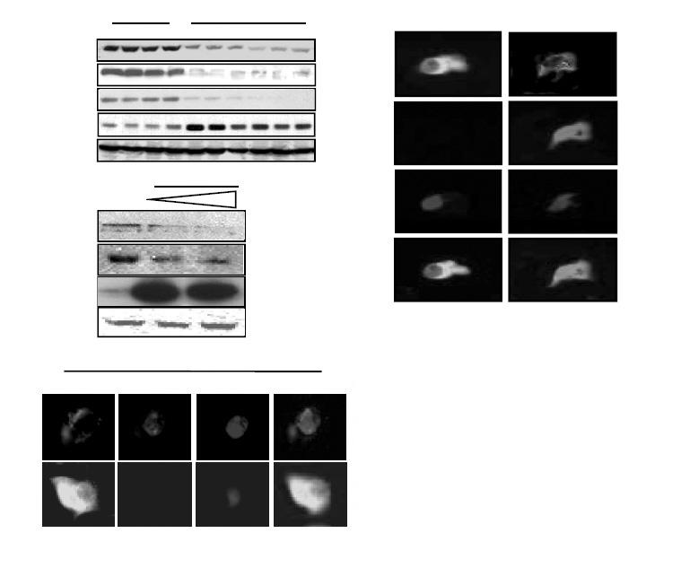 ATF3 regulates expression and pancreatic β-cells apoptosis Insulin Merge B IP: Ab C EtOH IB: 3-NT Ab Pair-fed PHWR, KCDC EtOH L-NMMA /EtOH Nitrated Cell lysates: β-actin EtOH fed Figure 10.