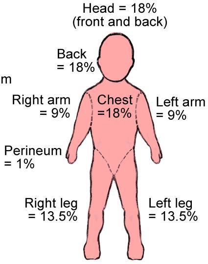 화상면적의산출 9의법칙