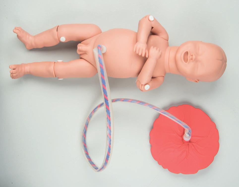닐링둔위 자궁안에서태아의다리를구부리거나세움 자주발생하는난산종류 태아의머리안정화및인도태아는벌린입을가지고있습니다.