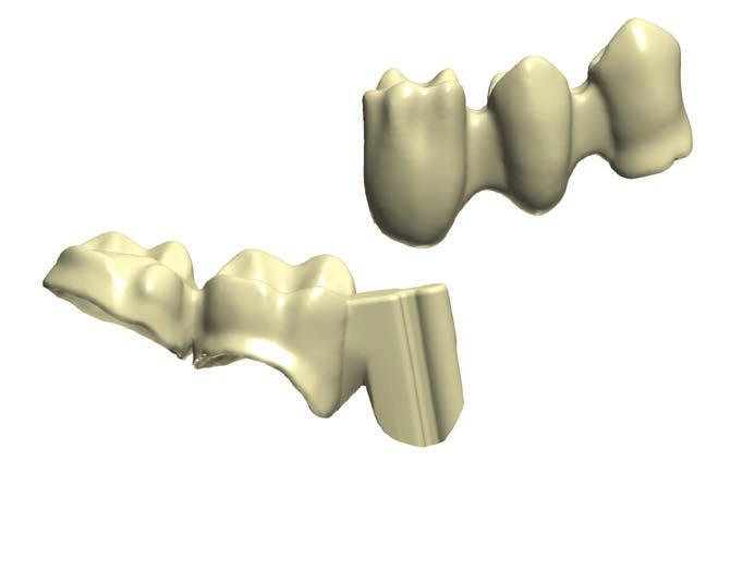 코핑및프레임워크로새로운수준의생산성달성 O Dental System