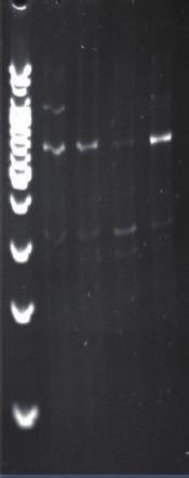 또한 adaptor 상의문제뿐만아니라, ligation 온도의차이를검토하였는데, 다른반응온도조건으로 IRS-PCR 을실시하였다. 실온의조건에서는반응이잘이루어지지않았으나 (Fig. 3A), 16 에서 ligation 을실시하였을때더욱 PCR 결과가안정되었다 (Fig. 3B). 결과 1. 항생제감수성결과총 51 개균주감수성결과 aztreonam 는 88.