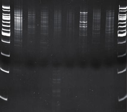 8 JH Byun, et al. IRS-PCR on E. coli www.icjournal.org 1 2 3 4 5 6 7 8 9 10 1 2 3 4 5 6 7 8 9 10 A B Figure 3. IRS-PCR electrophoretic patterns of ESBL E.