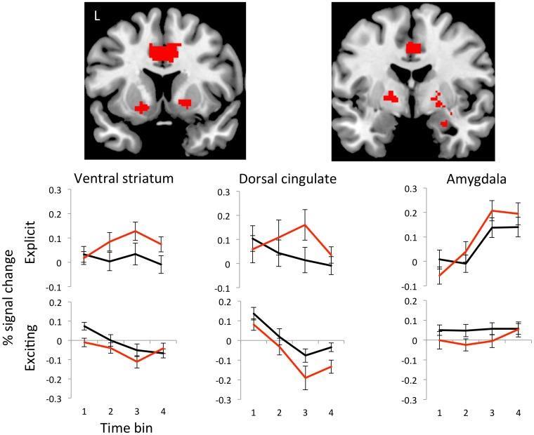 중독과뇌 연구팀에따르면섹스중독환자는뇌의배측선조체 (ventral striatum) 와배측전대상피질 (dorsal cingulate), 편도체 (amygdala) 가특히활발한반응을보였다.