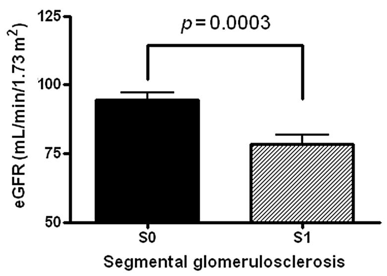 (B) Segmental glomerulosclerosis. (C) Endocapillary hypercellularity. (D) Tubular atrophy/interstitial fibrosis.