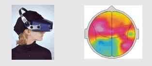 3.2 해외탐방 영국 NeuroInsight 인터뷰내용 Q) NeuroInsight 에서는왜 SST 기술을사용하나요? SST는고글형태의기계를이용하여 30Hz마다 ' 반짝 ' 하는빛을내보내어피실험자의눈과뇌가그빛에반응하는속도와반응하는부위를측정한다. SST 는기존에가장널리쓰인뉴로마케팅기법인 EEG와 fmri의단점을보완할수있다.