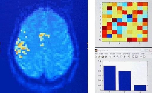 이는산소를빼앗긴주변뇌영역에서의헤모글로빈에더높은신호 (BOLD 신호 ) 를보이게되는데, fmri는이를측정하여특정인지기능을수행하는뇌영역을분석할수있도록하는기능적뇌지도화 (functional brain mapping)