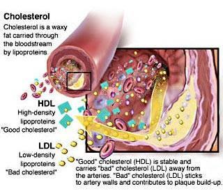 200 mg/dl 에서 239 mg/dl 사이이면심근경색증이나뇌졸중 바람직한 LDL 콜레스테롤치는 130 mg/dl 이하이며 LDL 콜레스테롤이 160 mg/dl