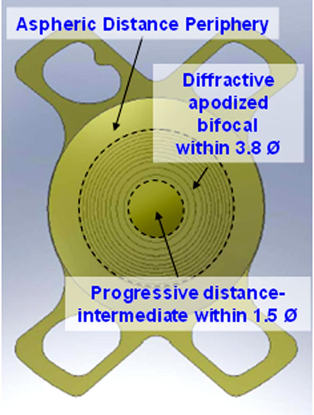 - 대한안과학회지 213 년제 54 권제 8 호 - 을조사하였다. 대상과방법 Figure 1. The design of OptiVis TM aspheric multifocal intraocular lens.