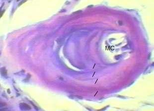 대부분의거의모든절단부위에서 ML 은발견되며( 그림 13), LAGs 흡수는보이지않는다. 그림 13. 제주도롱뇽의발가락단면사진. 왼쪽은수컷 5 살, 오른쪽은암컷 4 살. MC: 골수강(marrow cavity), 실선: LAG(line of arrested growth).