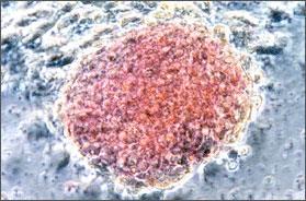 인간세포사람은체격에따라 60 조에서 100 조개정도의세포로이루어져있으며각세포는모두동일한유전자를가지고있다.