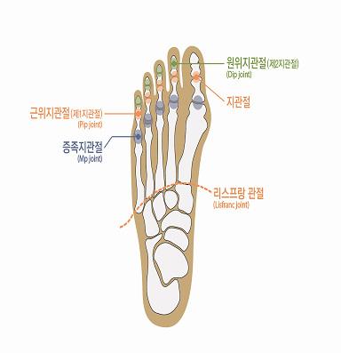 6) 발가락에뚜렷한장해를남긴때 라함은첫째발가락의경우에중족지관절과지관절의굴신 ( 굽히고펴기 ) 운동범위합계가정상운동가능영역의 1/2 이하가된경우를말하며, 다른네발가락에있어서는중족지관절의신전운동범위만을평가하여정상운동범위의 1/2이하로제한된경우를말한다.
