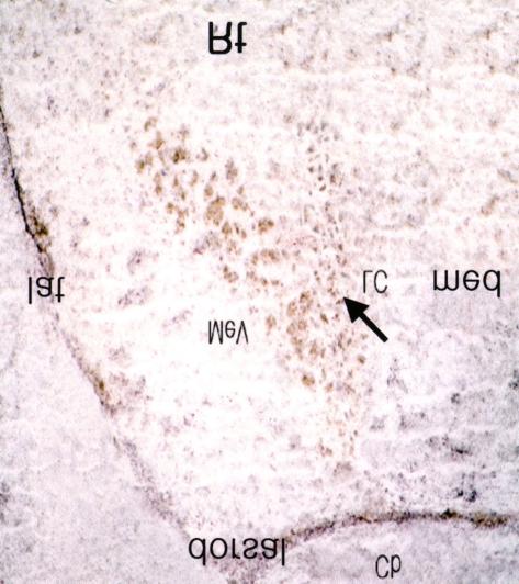 실 군과 생리식염수를 처치한 대조군의 c-fos 면역조직화학반 험군에서 c-fos 면역조직화학반응 양성세포들은 LC의 배측 Fig. 1.