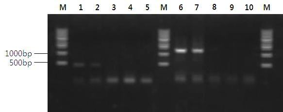 180 박현경ㆍ전려진ㆍ김승민ㆍ박명애ㆍ조미영ㆍ황성돈ㆍ박신후ㆍ정현도ㆍ정준범 RSIVD,. 2 2, 3.3%., VHSV 3 2 (3.3%) (Fig. 1, Table 4), 30 6.7%. 15 cm, VHSV Kim et al. (2009). VHSV 3 15, 10-15 (Kim et al., 2003). Fig. 1. Detection of the VHSV gene by RT-PCR using the N (lane 1-5) or G (lane 6-10) primer set.