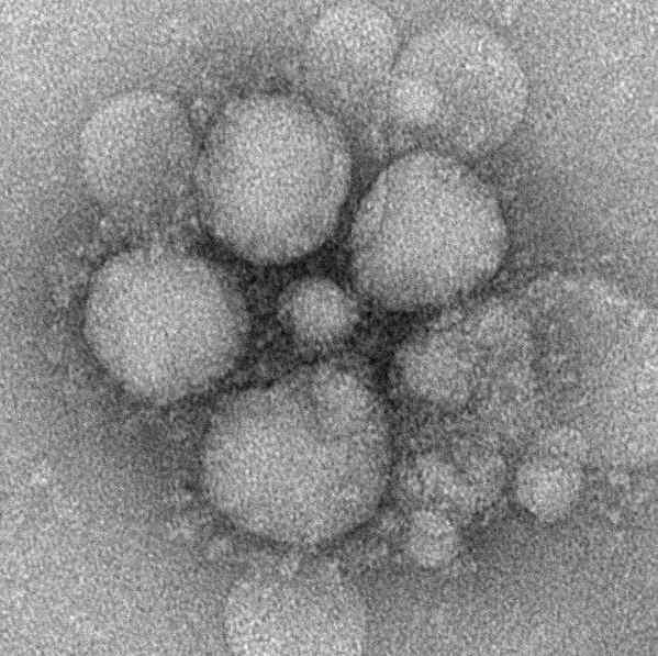 [ 제 4 군 ] 중동호흡기증후군 ( 메르스, MERS) 2018.9.13. 기준 구분 감염병분류 원인병원체 제4군법정감염병 중동호흡기증후군을유발하는코로나바이러스 (Middle East Respiratory Syndrome Coronavirus ; MERS-CoV) 발생현황 관련진단검사 및신고기준 - https://commons.wikimedia.