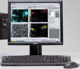 합성신약도입에따른세포형태나운동성변화를실시간모니터링 - 항암및항혈관치료제효능실시간분석 - 바이오신약의세포독성실시간분석 생체내이미지분석시스템 (In Vivo Imaging System, 모델명 : IVIS Lumina II by Caliper Life Sciences)