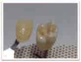 Improving flexural strength of dental restorative ceramics using