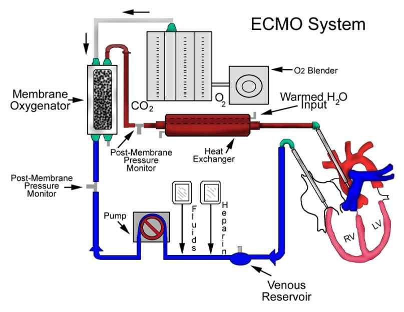 (extracorporeal membrane oxygenation: ECMO) 12)