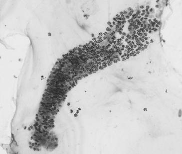 Ⅱ 가 개요 1) 병원체 : Kudoa septempunctata 가 ) 분류체계문 : 점액포자충아문 (Myxozoa), 약 2,000여종강 :