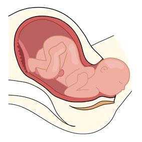 출산과정 진통시작부터자궁입구가열릴 때까지의시기, 진통이오면자궁 수축과함께양수가흘러나온다. 자궁입구가완전히열려서태아의 머리가산도를통해서서히빠져나 온다.