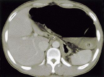 Abdominal CT scans.