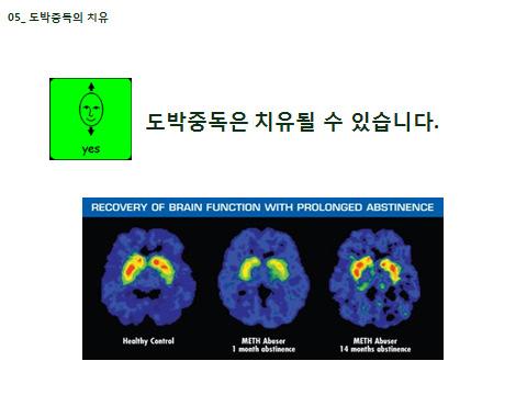 위의사진은뇌에서의도파민의활성화를나타낸사진이다. 가장왼쪽의뇌는건강한뇌이고, 가운데는메타암페타민을 1 달동안사용하지않은경우이며, 마지막세번째사진은사용을멈춘지 14개월이지난후의뇌사진이다.