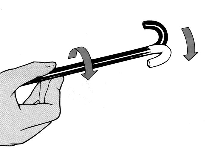 Figure 2. Torque. With a clockwise shaft twist, an up-angled tip moves to the right and a down-angled tip moves to the left. 기위하여내시경을뒤로잡아뺄때도비트는힘을가하면서빼면내시경선단부가삽입된위치에서빠져버림이없이루프를풀수있다.