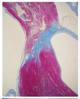 SPECIAL REVIEW A TT AV MV B HB TV TV C D INF AO HB RC TV Figure 2. A. histological section at piece #3 of Fig 1 showing the atrioventricular node (AV) over the fibrous annulus at the atrial surface.