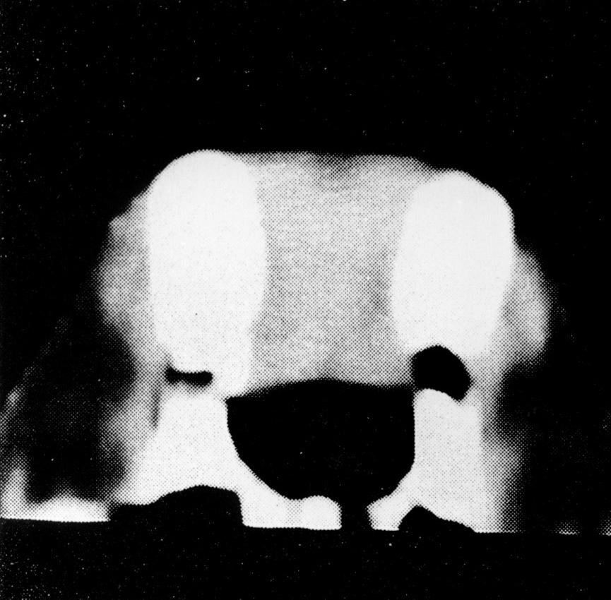 2)에 입력하여 자동적으로 각 분절의 단면적을 계 MRI에서는 치아의 간섭현상에 의해 선명한 영상을 얻기 산하였다(Fig. 3).