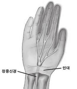 0 손목터널증후군 Carpal tunnel syndrome 기초정보 손목쪽을지나가는주요신경은 3개입니다.