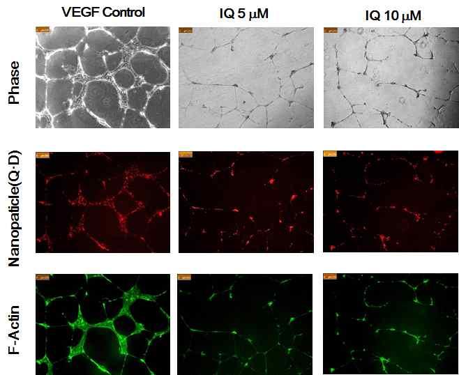 간세포생존및기능유지 3D 세포배양기술 (in vitro) p53 경로활성화및 Wnt/β-catenin 경로억제활성물질탐색 - HEK293 세포, Wnt3a-분비 L 세포대상 β-catenin 양감소화합물발굴 - p53 신호전달활성화하는동시에 Wnt/β-catenin 신호전달억제확인 (in vitro) Ilimaquinone(IQ) 의망막신생혈관성장억제확인