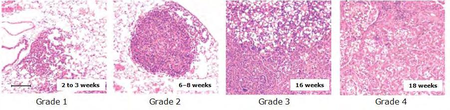 2009; 4(7):1064-1072) 본연구진의예비실험결과, 자발적종양모델은세포주입형종양모델과방사선반응성이다르고, 종양혈관구조의변화를관찰하기에적절한모델임을확인할수있었음.