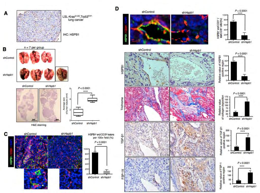 자발적비소세포암동물모델에서 HSPb1 에의한 혈관내피세포의간엽세포로의전이 (EndMT) 를확인 그림설명 ) (A) 자발적비소세포암동물모델인 K-ras LSL-GLD/+ ;p53 fl/fl (KP) 마우스의폐에 Ade-Cre를감염시켜 adenocarcinoma를유도.